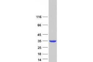 Western Blotting (WB) image for Sulfotransferase Family, Cytosolic, 1A, Phenol-Preferring, Member 2 (SULT1A2) (Transcript Variant 1) protein (Myc-DYKDDDDK Tag) (ABIN2732930)
