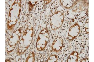 Immunoperoxidase of monoclonal antibody to IKBKAP on formalin-fixed paraffin-embedded human colon. (IKAP/p150 antibody  (AA 1242-1331))