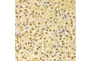 Immunohistochemistry of paraffin-embedded mouse kidney using CDC25A antibody (ABIN5970519) at dilution of 1/100 (40x lens). (CDC25A antibody)