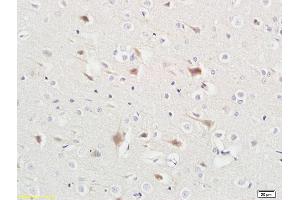 Formalin-fixed and paraffin embedded rat liver tissue labeled with Anti-ABHD5 Polyclonal Antibody, Unconjugated (ABIN708596) at 1:200 followed by conjugation to the secondary antibody and DAB staining (ABHD5 antibody  (AA 281-349))
