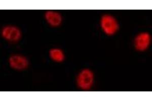 ABIN6275127 staining HepG2 by IF/ICC. (FOXB2 antibody  (Internal Region))