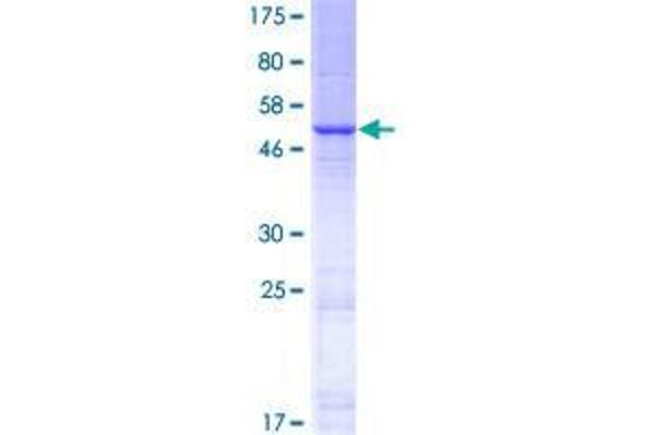 STARD6 Protein (AA 1-220) (GST tag)