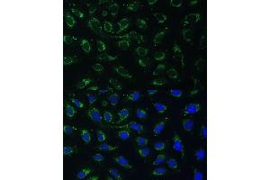 Immunofluorescence (IF) image for anti-Aldo-keto Reductase Family 1, Member C2 (AKR1C2) (AA 1-323) antibody (ABIN7265549)