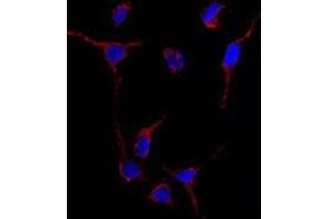 Image no. 1 for anti-Aldehyde Dehydrogenase 1 Family, Member A1 (ALDH1A1) (Center) antibody (ABIN356973)