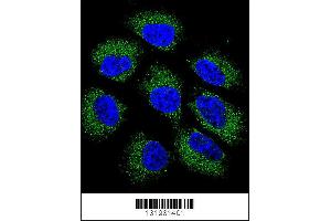 Confocal immunofluorescent analysis of GSR Antibody with NCI-H460 cell followed by Alexa Fluor 488-conjugated goat anti-rabbit lgG (green). (GS (AA 380-408), (C-Term) antibody)