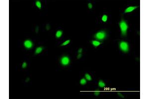 Immunofluorescence of purified MaxPab antibody to ANXA1 on HeLa cell. (Annexin a1 antibody  (AA 1-346))