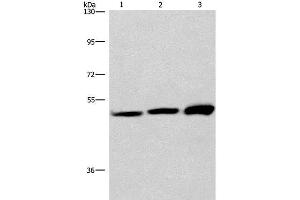 Western Blot analysis of adrenal pheochromocytoma tissue,Jurkat and A549 cell using VWA5A Polyclonal Antibody at dilution of 1:275 (VWA5A antibody)