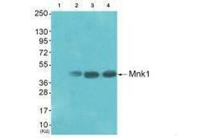 Western blot analysis of extracts from HepG2 cells (Lane 2), K562 cells (Lane 3) and Jurket cells (Lane 4), using Mnk1 (Ab-385) antiobdy. (MKNK1 antibody  (Thr385))
