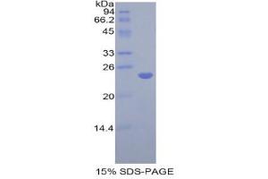 SDS-PAGE (SDS) image for Catechol-O-Methyltransferase (COMT) (AA 63-264) protein (His tag) (ABIN2120755)