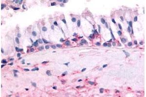 Immunohistochemical (Formalin/PFA-fixed paraffin-embedded sections) staining in human nasal mucosa, respiratory epithelium with OR10J5 polyclonal antibody . (OR10J5 antibody  (2nd Extracellular Domain))