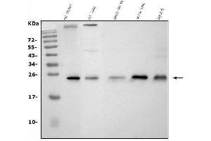 Western blot analysis of CD9 using anti-CD9 antibody (ABIN4886531).