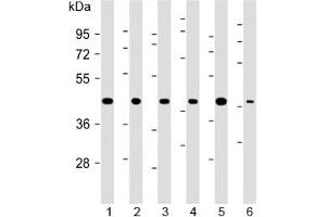 Western blot testing of 1) human 293, 2) (h) HeLa, 3) (h) MDA-MB-231, 4) rat H-4-II-E, 5) (h) HCT-116 and 6) mouse C2C12 cell lysate with TBP antibody at 1:2000. (TBP antibody)