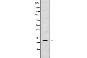 Western blot analysis of RAB1A using HT29 whole cell lysates (RAB1A antibody  (C-Term))