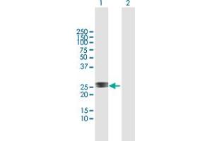 Western Blot analysis of RAD54B expression in transfected 293T cell line by RAD54B MaxPab polyclonal antibody. (RAD54B antibody  (AA 1-158))