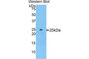 Western blot analysis of the recombinant protein. (MYH8 antibody  (AA 40-240))