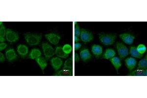 ICC/IF Image ACAT1 antibody [N1N3] detects ACAT1 protein at mitochondria by immunofluorescent analysis. (ACAT1 antibody  (N-Term))