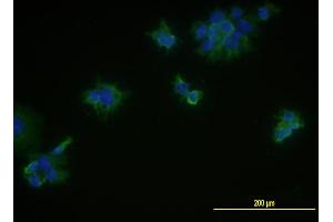 Immunofluorescence of monoclonal antibody to MCAM on JAR cell .