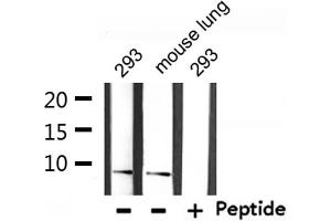 Western blot analysis of extracts from 293 and mouse lung, using Ubiquitin Antibody. (UBA52 antibody  (Internal Region))