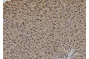 ABIN6276878 at 1/100 staining Mouse liver tissue by IHC-P. (Dynactin 1 antibody  (C-Term))