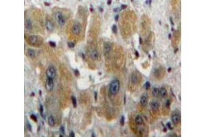 Used in DAB staining on fromalin fixed paraffin-embedded Liver tissue (CA1 antibody  (AA 2-261))