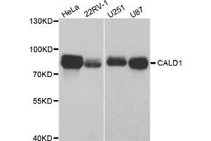 Western blot analysis of extracts of various cell lines, using CALD1 antibody (ABIN5973102) at 1/1000 dilution. (Caldesmon antibody)