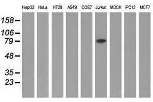 Image no. 1 for anti-Aldehyde Dehydrogenase 1 Family, Member L1 (ALDH1L1) antibody (ABIN1496581) (ALDH1L1 antibody)