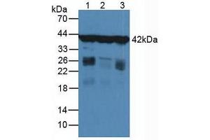 Figure. (Actin, gamma 1 antibody  (AA 1-375))
