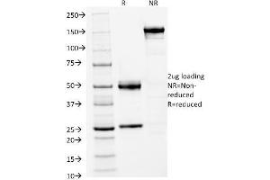 SDS-PAGE (SDS) image for anti-Forkhead Box A1 (FOXA1) (AA 372-472) antibody (ABIN6939651)