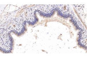 Detection of COL8a1 in Human Lung Tissue using Monoclonal Antibody to Collagen Type VIII Alpha 1 (COL8a1) (COL8A1 antibody  (AA 575-743))