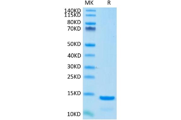beta-2 Microglobulin Protein (AA 21-119) (His tag)