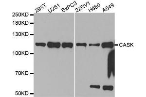 Western blot analysis of extracts of various cell lines, using CASK antibody. (CASK antibody  (AA 1-300))