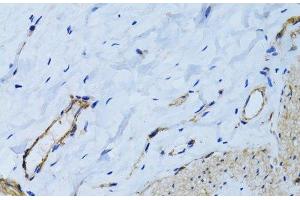 Immunohistochemistry of paraffin-embedded Human colon using MCAM Polyclonal Antibody at dilution of 1:100 (40x lens).