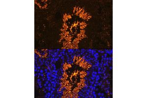 Immunofluorescence analysis of Mouse testis using  antibody (ABIN7265353) at dilution of 1:100. (AKAP4 antibody  (AA 189-340))