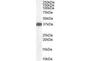Image no. 1 for anti-Dimethylarginine Dimethylaminohydrolase 1 (DDAH1) (C-Term) antibody (ABIN374149) (DDAH1 antibody  (C-Term))