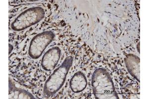 Immunoperoxidase of monoclonal antibody to CAPZB on formalin-fixed paraffin-embedded human small Intestine. (CAPZB antibody  (AA 192-272))