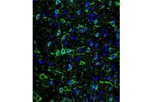 Immunofluorescent staining of brain tissue reacted with MAP2 monoclonal antibody  at 1:10-1:50 dilution. (MAP2 antibody)