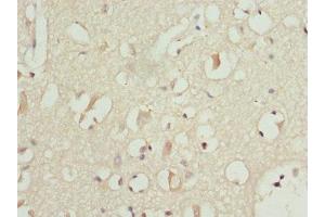 Immunohistochemistry of paraffin-embedded human brain tissue using ABIN7164274 at dilution of 1:100 (PITRM1 antibody  (AA 758-1037))
