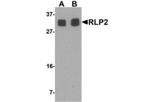 Western blot analysis of RLP2 in A549 cell lysate with RLP2 antibody at (A) 1 and (B) 2 ug/mL. (RILPL2 antibody  (Middle Region))