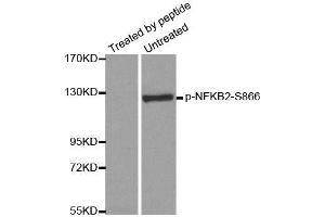 Western blot analysis of extracts from ovary cancer cells, using Phospho-NFKB2-S866 antibody (ABIN2988214).