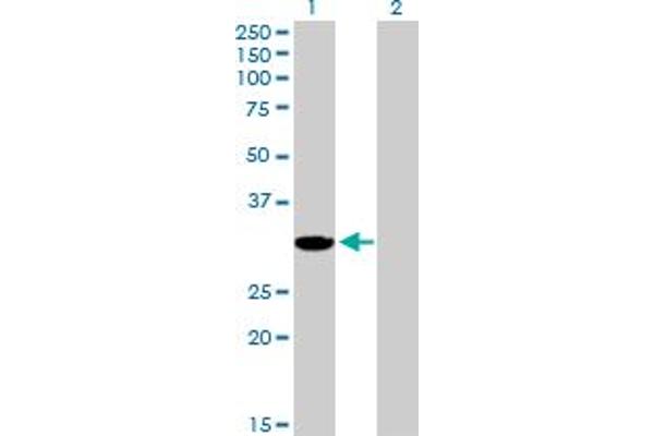 AKR1E2 antibody  (AA 1-307)