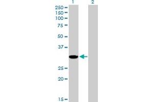 Western Blot analysis of AKR1CL2 expression in transfected 293T cell line by AKR1CL2 MaxPab polyclonal antibody. (AKR1E2 antibody  (AA 1-307))