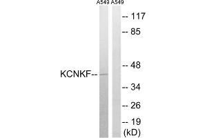 Western blot analysis of extracts from A549 cells, using KCNK15 antibody.