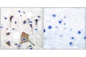 Immunohistochemistry analysis of paraffin-embedded human brain tissue, using GluR5 Antibody. (GRIK1 antibody  (AA 10-59))