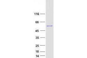 Validation with Western Blot