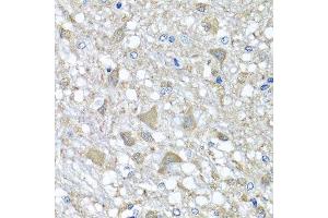 Immunohistochemistry of paraffin-embedded rat brain using VPS37A antibody. (VPS37A antibody  (AA 224-397))
