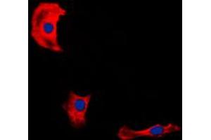 Immunofluorescent analysis of Fibulin 4 staining in HepG2 cells. (FBLN4 antibody  (Center))