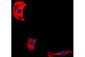 Immunofluorescent analysis of Fibulin 4 staining in HepG2 cells.