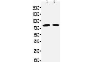 Anti-Transglutaminase 2 antibody, Western blotting Lane 1: JURKAT Cell Lysate Lane 2: HELA Cell Lysate (Transglutaminase 2 antibody  (C-Term))