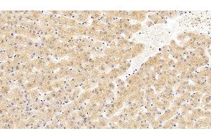 Detection of ANG in Human Liver Tissue using Monoclonal Antibody to Angiogenin (ANG) (ANG antibody  (AA 25-147))