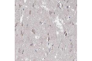 ABIN6266661 at 1/100 staining human brain tissue sections by IHC-P. (SUMO1 antibody  (N-Term))